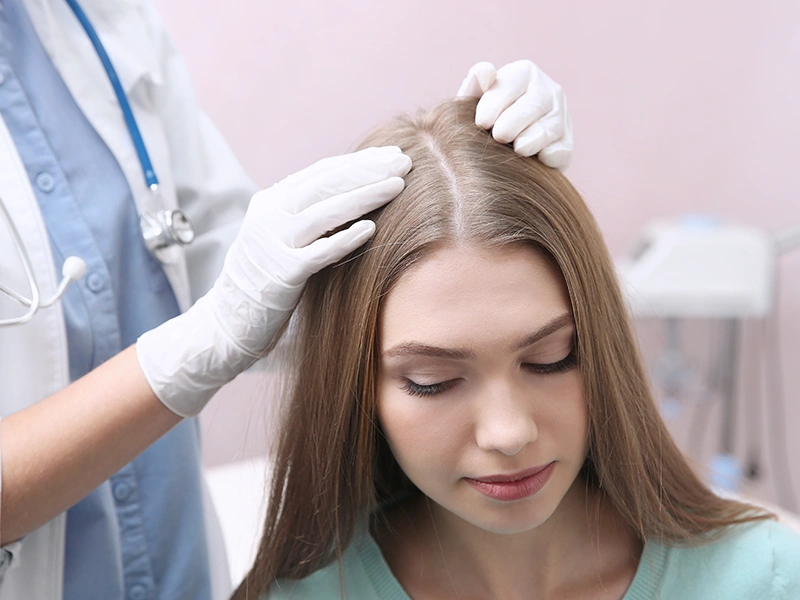 Candidate for female hair transplant